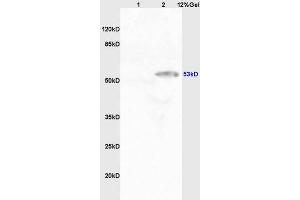 Image no. 5 for anti-Cytochrome P450, Family 11, Subfamily A, Polypeptide 1 (CYP11A1) (AA 321-420) antibody (ABIN701530)
