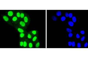 Image no. 2 for anti-Histone Deacetylase 8 (HDAC8) antibody (ABIN5557483)