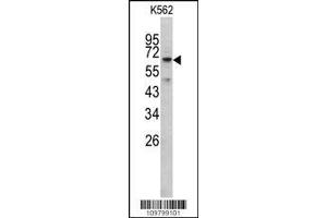 Image no. 2 for anti-RIO Kinase 1 (RIOK1) (AA 126-156), (N-Term) antibody (ABIN391301)