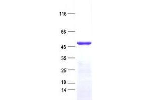 Image no. 1 for Zinc Finger Protein 643 (ZNF643) protein (His tag) (ABIN2736089)