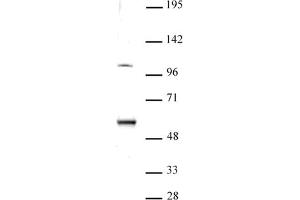 Image no. 1 for anti-Elongator complex protein 3 (ELP3) (N-Term) antibody (ABIN6971627)