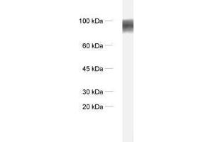 anti-ADAM Metallopeptidase Domain 22 (ADAM22) antibody