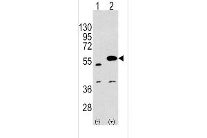 Image no. 2 for anti-Sprouty-Related, EVH1 Domain Containing 1 (SPRED1) (C-Term) antibody (ABIN2503530)