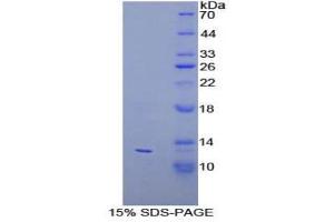 Image no. 1 for Peroxisomal Biogenesis Factor 2 (PEX2) (AA 28-118) protein (His tag) (ABIN1879724)