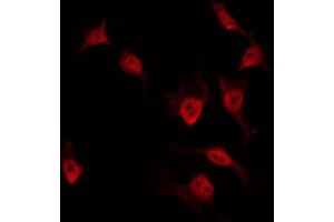 Image no. 1 for anti-Zinc Finger CCCH-Type Containing 7B (ZC3H7B) antibody (ABIN6258361)