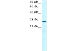 Image no. 2 for anti-Kruppel-Like Factor 8 (KLF8) (N-Term) antibody (ABIN2777342)