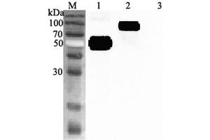 Image no. 1 for anti-Interleukin 1 Receptor-Like 1 (IL1RL1) antibody (ABIN1169349)