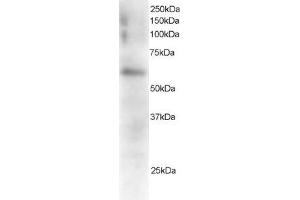 Image no. 2 for anti-Gardner-Rasheed Feline Sarcoma Viral (V-Fgr) Oncogene Homolog (FGR) (C-Term) antibody (ABIN184643)