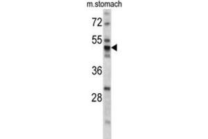 Image no. 2 for anti-Protein Disulfide Isomerase Family A, Member 6 (PDIA6) antibody (ABIN3002737)