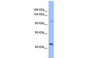Image no. 1 for anti-Xylosyltransferase II (XYLT2) (AA 575-624) antibody (ABIN6741764)