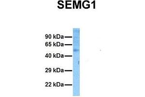Image no. 1 for anti-Semenogelin I (SEMG1) (N-Term) antibody (ABIN2777136)