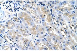 Image no. 5 for anti-Tumor Susceptibility Gene 101 (TSG101) (Middle Region) antibody (ABIN2780037)
