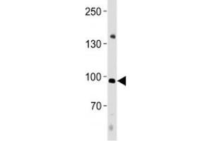 Image no. 1 for anti-Nuclear Factor of Activated T-Cells, Cytoplasmic, Calcineurin-Dependent 4 (NFATC4) (AA 744-773) antibody (ABIN3032040)