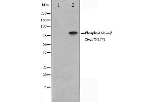 Image no. 5 for anti-conserved Helix-Loop-Helix Ubiquitous Kinase (CHUK) (pSer176), (pSer177) antibody (ABIN6256173)