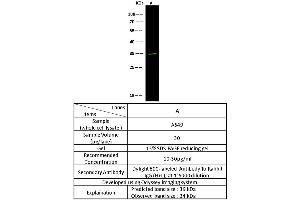 Image no. 2 for anti-alpha 1 Microglobulin/bikunin precursor (AMBP) (AA 1-203) antibody (ABIN2691446)