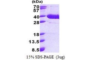 Image no. 1 for Nuclear Factor of kappa Light Polypeptide Gene Enhancer in B-Cells Inhibitor, delta (NFKBID) (AA 1-313) protein (His tag) (ABIN5853211)