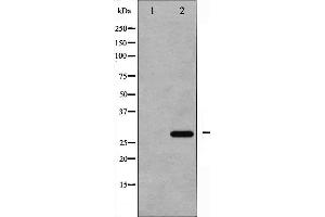 Western blot analysis of p27 Kip1 phosphorylation expression in EGF treated HeLa whole cell lysates,The lane on the left is treated with the antigen-specific peptide.