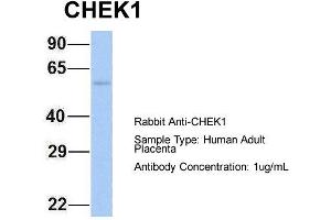 Image no. 7 for anti-Checkpoint Kinase 1 (CHEK1) (Middle Region) antibody (ABIN2779737)