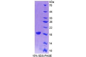 Image no. 1 for Cellular Retinoic Acid Binding Protein 1 (CRABP1) (AA 2-137) protein (T7 tag,His tag) (ABIN6239083)