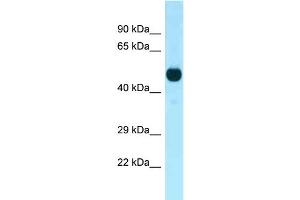 Image no. 1 for anti-Cyclin-Dependent Kinase 14 (CDK14) (C-Term) antibody (ABIN2788962)
