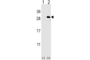 Image no. 5 for anti-Eukaryotic Translation Initiation Factor 4E Family Member 2 (EIF4E2) antibody (ABIN3028646)