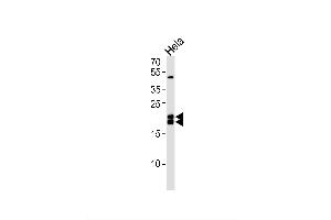 Image no. 1 for anti-Caveolin 1, Caveolae Protein, 22kDa (CAV1) antibody (ABIN1944910)
