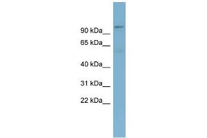 anti-Transducin (Beta)-Like 3 (TBL3) (N-Term) antibody