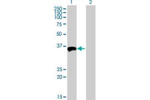 Image no. 2 for anti-Antigen P97 (Melanoma Associated) Identified By Monoclonal Antibodies 133.2 and 96.5 (MFI2) (AA 1-302) antibody (ABIN517892)