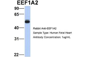 anti-Eukaryotic Translation Elongation Factor 1 alpha 2 (EEF1A2) (Middle Region) antibody