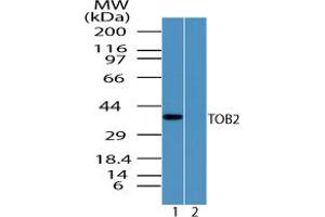 Image no. 1 for anti-Transducer of ERBB2, 2 (TOB2) (AA 50-100) antibody (ABIN960385)