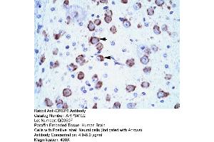 anti-Mediator Complex Subunit 17 (MED17) (N-Term) antibody