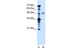 Image no. 1 for anti-Solute Carrier Family 39 (Zinc Transporter), Member 6 (SLC39A6) (Middle Region) antibody (ABIN2781630)