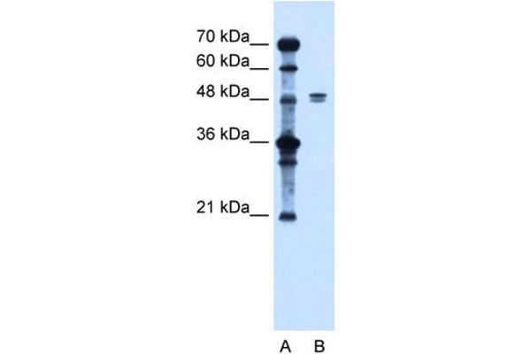 SLC39A6 Antikörper  (Middle Region)