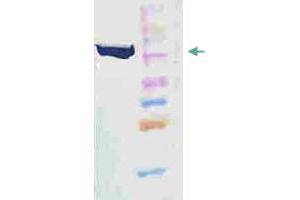 Image no. 3 for anti-Heat Shock Protein 90kDa beta (Grp94), Member 1 (HSP90B1) antibody (ABIN5580183)