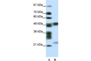 Image no. 1 for anti-PHD Finger Protein 11 (PHF11) (Middle Region) antibody (ABIN2776050)