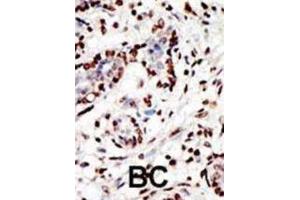 Image no. 2 for anti-Myeloid/lymphoid Or Mixed-Lineage Leukemia (MLL) antibody (ABIN2996098)