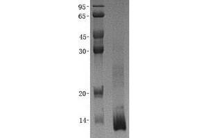 Image no. 1 for Dynein, Light Chain, LC8-Type 1 (DYNLL1) (Transcript Variant 1) protein (His tag) (ABIN2712279)