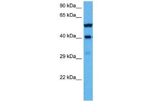 Image no. 4 for anti-Wilms Tumor 1 (WT1) (Middle Region) antibody (ABIN2780340)