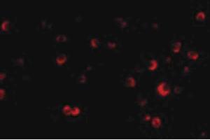 Image no. 2 for anti-Tuberous Sclerosis 2 (TSC2) (N-Term) antibody (ABIN6655755)