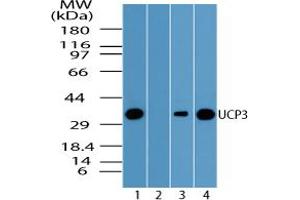Image no. 1 for anti-Uncoupling Protein 3 (Mitochondrial, Proton Carrier) (UCP3) (AA 125-175) antibody (ABIN960396)