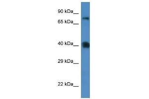Image no. 1 for anti-Solute Carrier Family 7 (Cationic Amino Acid Transporter, Y+ System), Member 3 (SLC7A3) (Middle Region) antibody (ABIN928033)