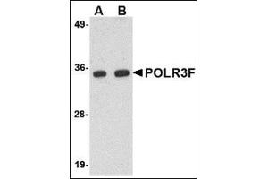 Image no. 2 for anti-Polymerase (RNA) III (DNA Directed) Polypeptide F, 39 KDa (POLR3F) (N-Term) antibody (ABIN500523)