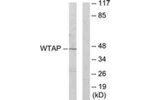 Image no. 1 for anti-Wilms Tumor 1 Associated Protein (WTAP) (AA 321-370) antibody (ABIN1533898)