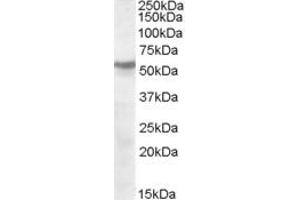 Image no. 1 for anti-Cholinergic Receptor, Nicotinic, beta 1 (Muscle) (CHRNB1) (Internal Region) antibody (ABIN263185)