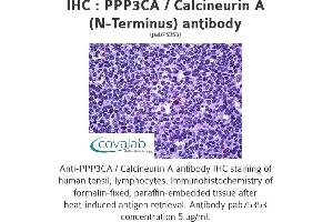 Image no. 3 for anti-Protein Phosphatase 3, Catalytic Subunit, alpha Isoform (PPP3CA) (N-Term) antibody (ABIN2851961)
