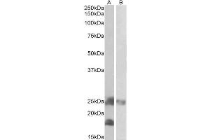 Image no. 1 for anti-Dynactin 3 (p22) (Dctn3) (Internal Region) antibody (ABIN571258)