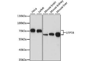 Image no. 1 for anti-WD Repeat Domain 50 (UTP18) antibody (ABIN6568703)