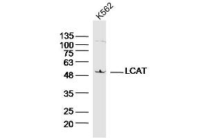 Image no. 3 for anti-Lecithin-Cholesterol Acyltransferase (LCAT) (AA 151-250) antibody (ABIN676118)