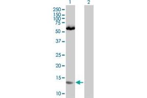 Image no. 1 for anti-SH3 Domain Binding Glutamic Acid-Rich Protein Like (SH3BGRL) (AA 1-114) antibody (ABIN520167)