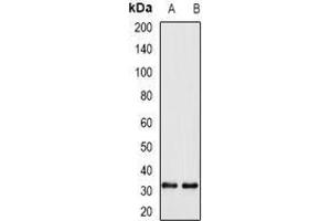 Image no. 3 for anti-Williams Beuren Syndrome Chromosome Region 22 (WBSCR22) (full length) antibody (ABIN6005804)